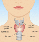 thyroid_gland_diag